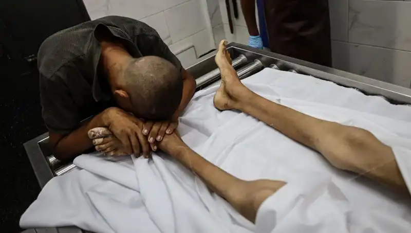 Gazze'de Açlık Alarmı: Bir Çocuk Daha Hayata Veda Etti